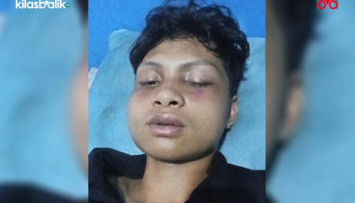 Dugaan Penyiksaan Dua Remaja di Wakatobi Viral, Korban dan Keluarga Minta Keadilan