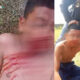 Video Dugaan Perkelahian Remaja di Baubau Viral, Satu Orang Alami Pendarahan